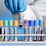 آزمایشگاه فعال ژنتیک در سعادت آباد